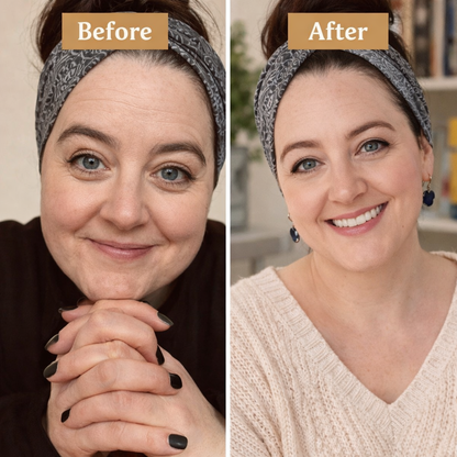 SheShine™️| Korean Madeca Time Reverse Cream